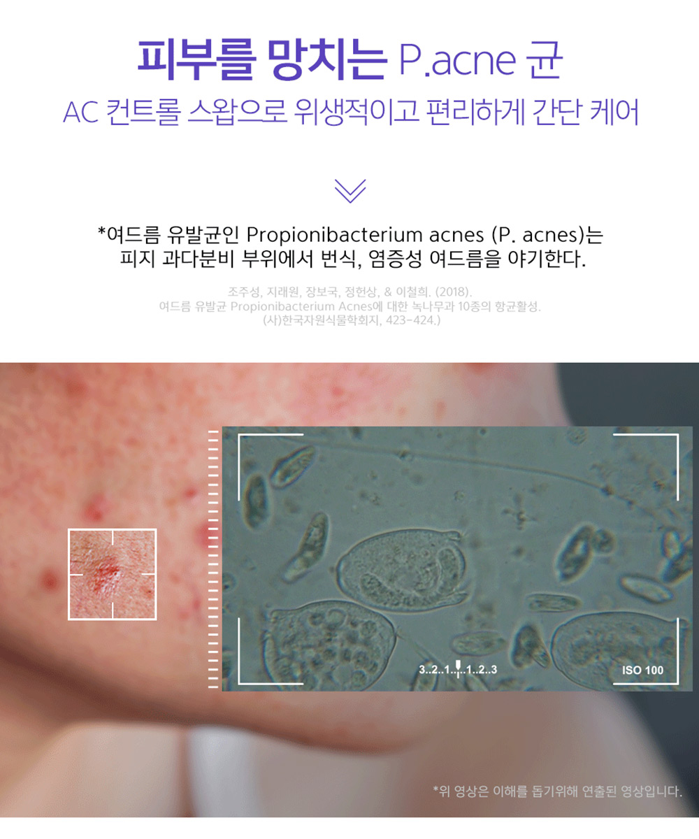 트러블 스왑 추천